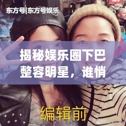 揭秘娛樂圈下巴整容明星，誰悄悄整過下巴？