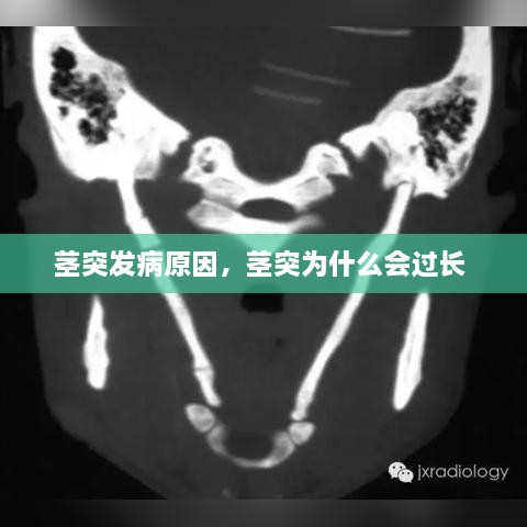莖突發(fā)病原因，莖突為什么會過長 