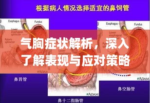 氣胸癥狀解析，深入了解表現(xiàn)與應(yīng)對策略