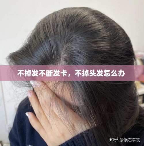 不掉發(fā)不斷發(fā)卡，不掉頭發(fā)怎么辦 