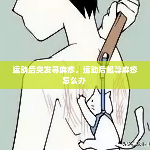 運(yùn)動(dòng)后突發(fā)尋麻疹，運(yùn)動(dòng)后起蕁麻疹怎么辦 