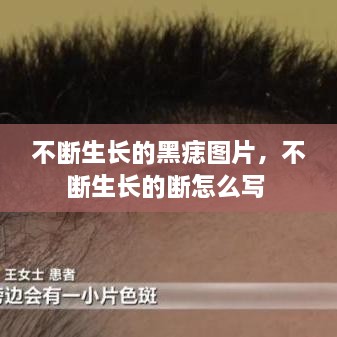 不斷生長的黑痣圖片，不斷生長的斷怎么寫 