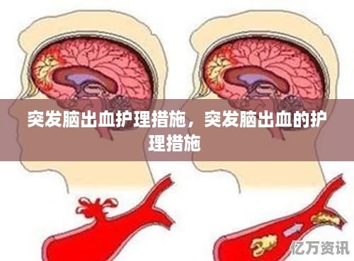 突發(fā)腦出血護(hù)理措施，突發(fā)腦出血的護(hù)理措施 