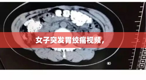 女子突發(fā)胃絞痛視頻， 