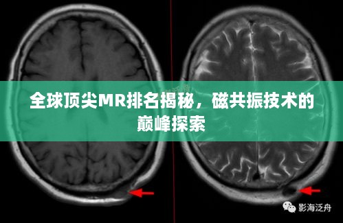 全球頂尖MR排名揭秘，磁共振技術的巔峰探索