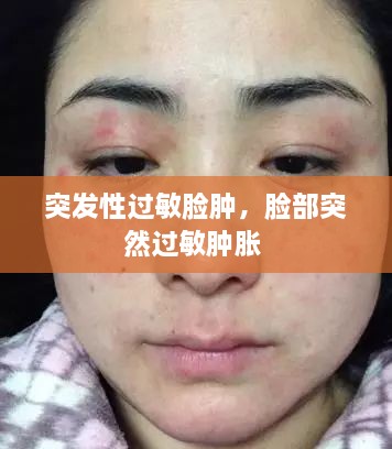 突發(fā)性過敏臉腫，臉部突然過敏腫脹 