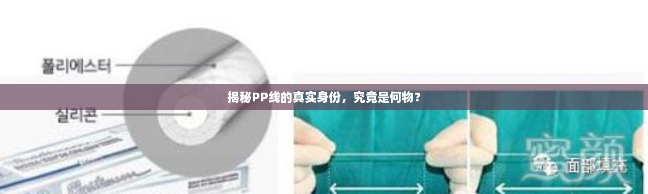 揭秘PP線的真實(shí)身份，究竟是何物？