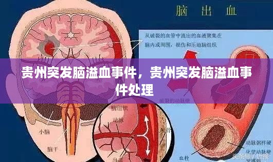 貴州突發(fā)腦溢血事件，貴州突發(fā)腦溢血事件處理 