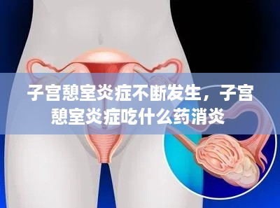 子宮憩室炎癥不斷發(fā)生，子宮憩室炎癥吃什么藥消炎 
