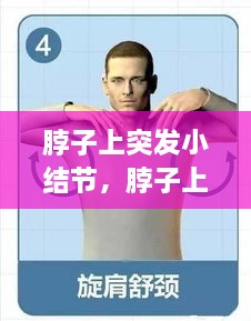 脖子上突發(fā)小結節(jié)，脖子上的小結節(jié)要緊嗎 