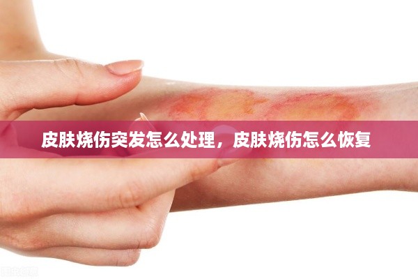 皮膚燒傷突發(fā)怎么處理，皮膚燒傷怎么恢復(fù) 