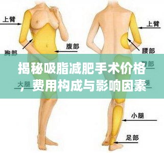 揭秘吸脂減肥手術價格，費用構成與影響因素全解析